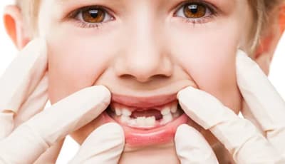 Urgencia dental Marbella