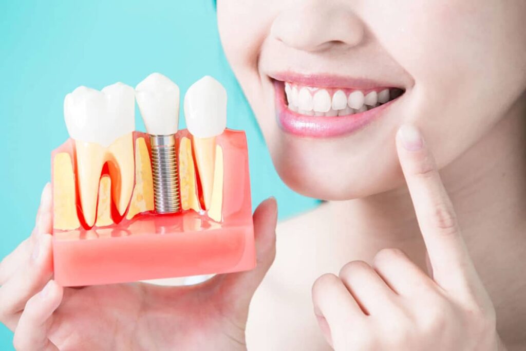 Implante o puente fijo